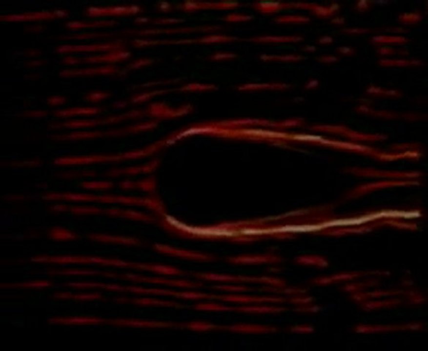 JEAN-PIERRE PETIT - LE MHD ET LES UNIVERS JUMEAUX