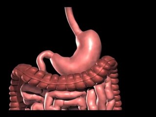 Lap band Surgery Austin