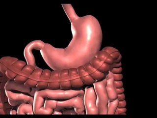 Lap band Surgery Austin