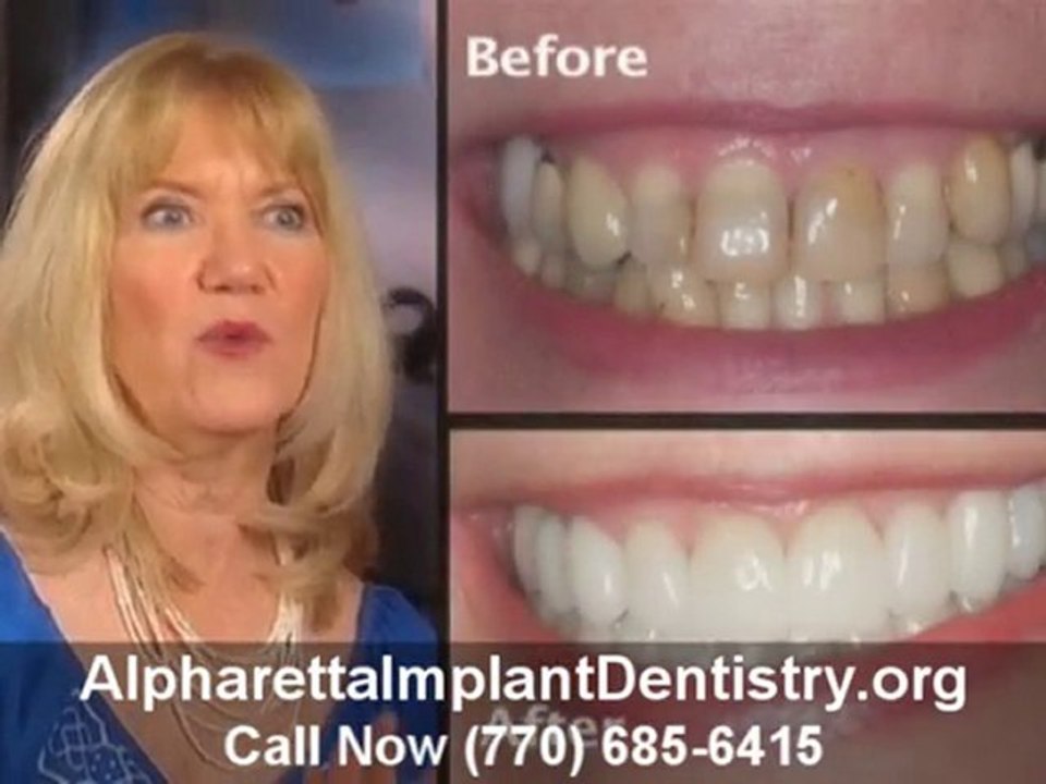 Alpharetta Implant Dentistry