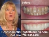 Best Cosmetic Dentist Marietta