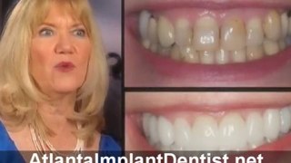 Atlanta Implant Dentist