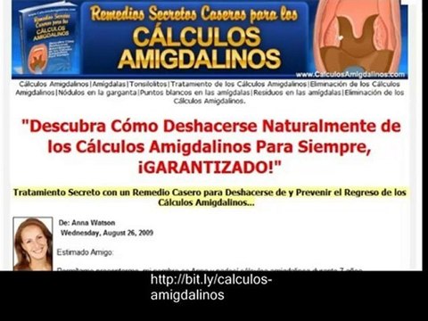 Tratamiento Para La Garganta - Calculos Amigdalinos