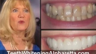 Teeth Whitening Alpharetta