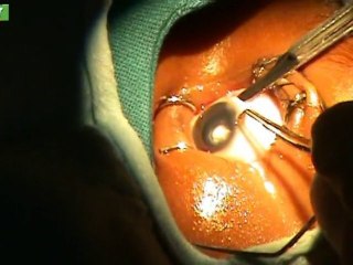 Rwanda - Hôpital Ophtamologique