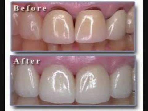 Miami Lakes Florida Dentist Eases Tooth Pain