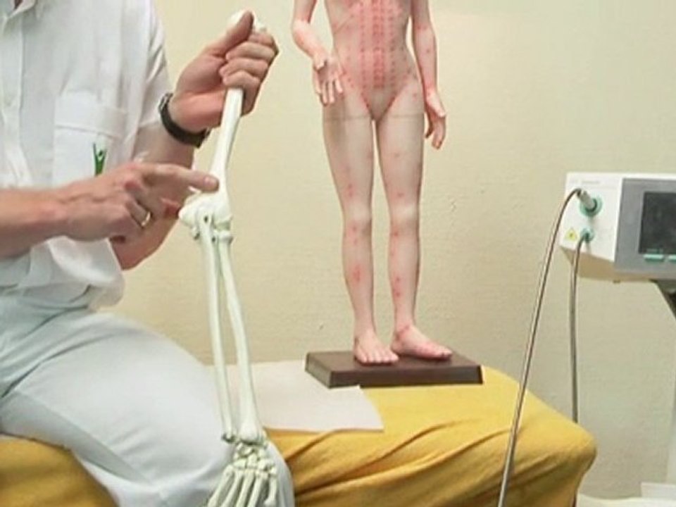 Tennis- und Golferarm. Symptome, Diagnostik, Behandlung