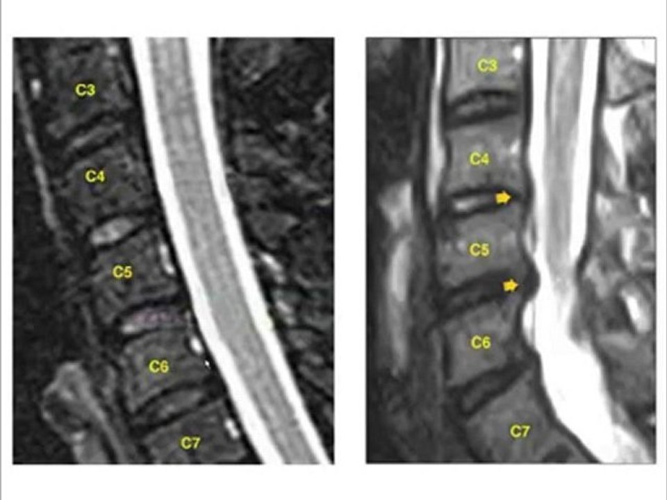Houston Attorney:  How A Neck or Back Injury is Proved ...