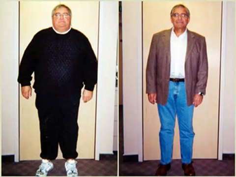 Gastric Band Dallas-Gastric Bypass Surgeon Dallas-Gastric B
