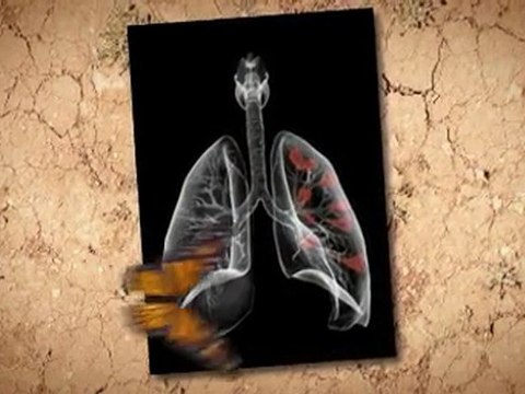 Asbestos Remova in Home Roswell GA