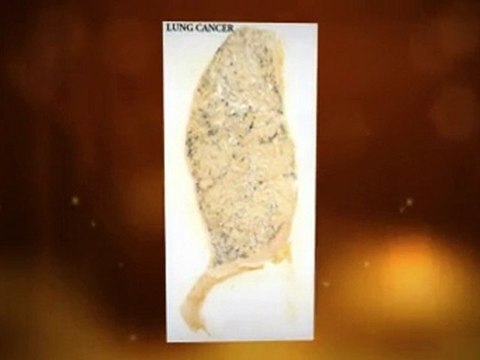 Asbestos Exposure Roswell GA