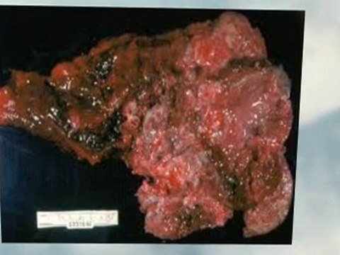 Asbestos Abatement Avondale AZ