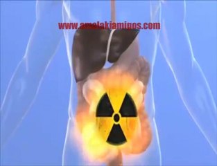 Accell complemento de nutriiveda y de zrii /www.amalakiamigo