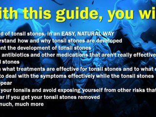 How To Get Rid Of Tonsil Stones - Tonsil Stones