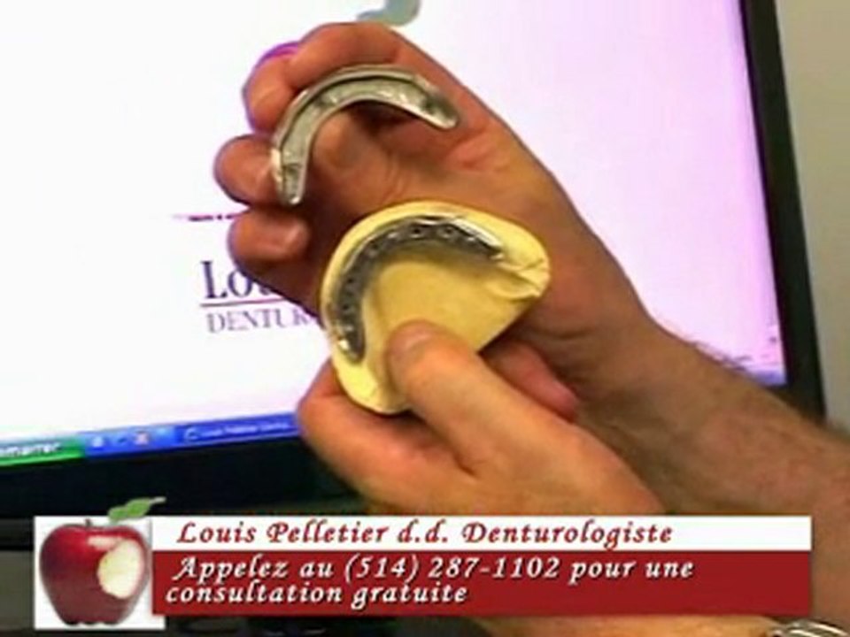Denturologiste Montreal Nord - Implants Dentaires