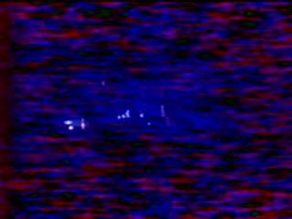 Korn Lille 97 - 02 Blind