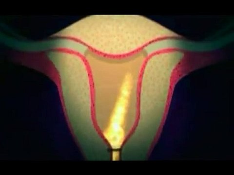 Espermatozoides (5): En la trompa de falopio