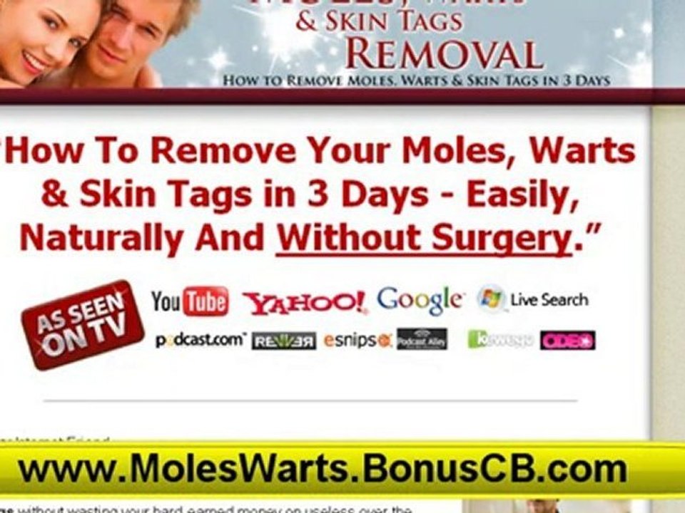Removing Moles Naturally - How To Remove Warts Fast