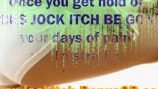 jock itch treatment - jock itch remedies