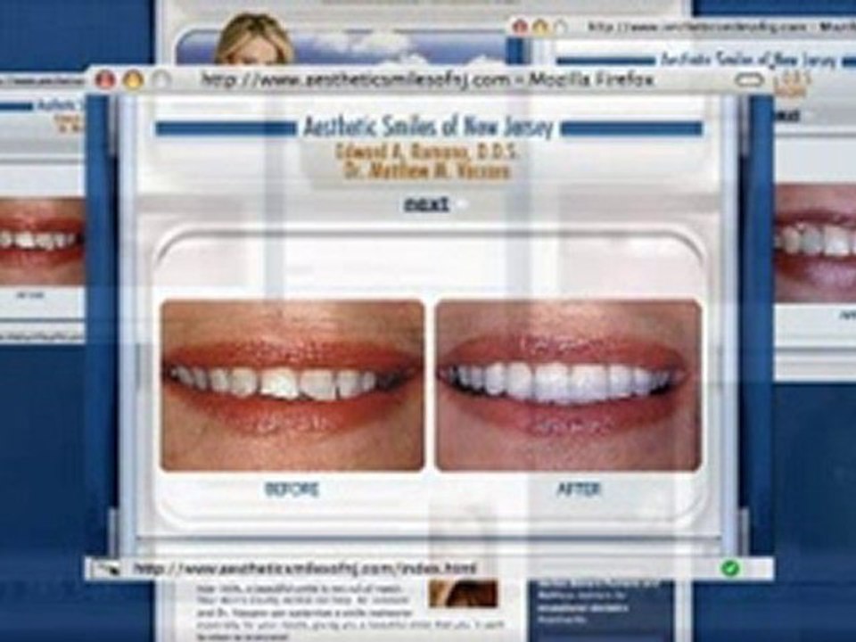 Welcome To Aesthetic Smiles of Morristown, New Jersey