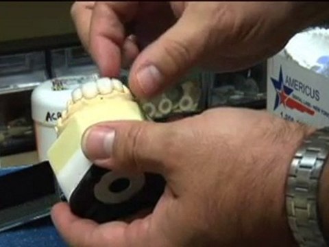 Porcelain Dental Veneers & Smile Makeovers Morristown NJ