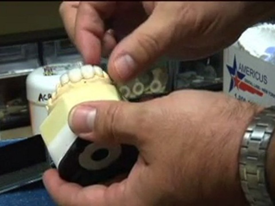 Porcelain Dental Veneers & Smile Makeovers Morristown NJ