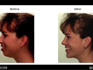 Maryland, Virginia & DC Plastic Surgery – Dr. Barry J. Cohen