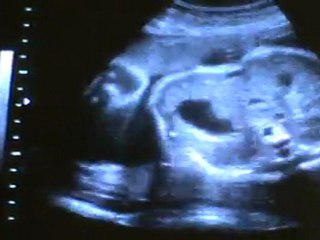 echo du 7e mois le 12 juillet