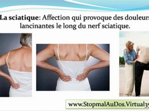 nerf sciatique - sciatique traitement - douleurs cervicales