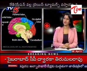Health File - Dr Ajay Reddy -Topic on Brain Tumor,Treatment_01