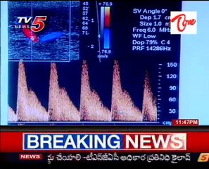 Sparsha,The Touch - Sex Problems-Treatment Advises with Dr K.Sridhar_02