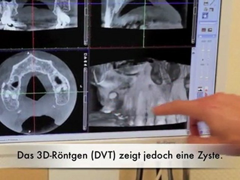 Ganzheitliche ZAHNDIAGNOSTIK: Was das Röntgenbild nicht sieht