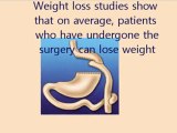 Gastric Bypass Bariatric Texas Weight Loss Surgery Result
