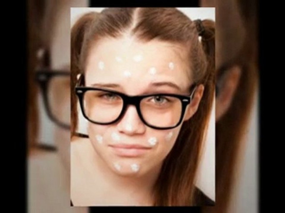 Get Rid of Acne Scars with the Help of Acne Scars Treatment NYC