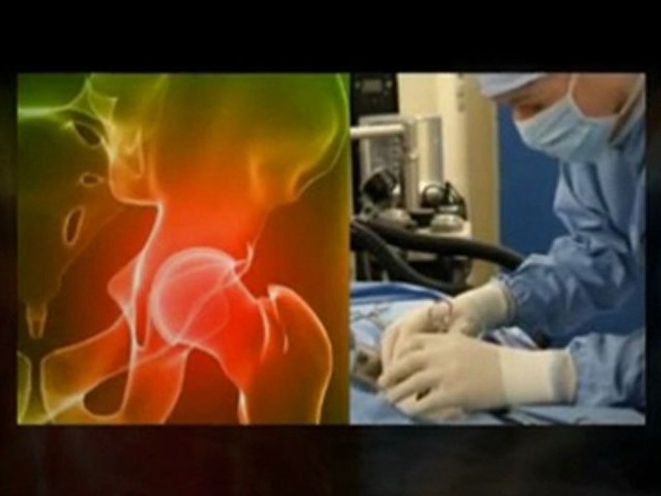 File DePuy Hip Recall Lawsuit