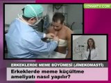 Erkeklerde meme kucultme ameliyati nasil yapilir - Op Dr Eser Aydogdu