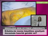 Erkeklerde meme kucultme ameliyatı-Op Dr Eser Aydogdu