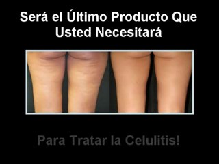 Remedios Naturales Para La Celulitis