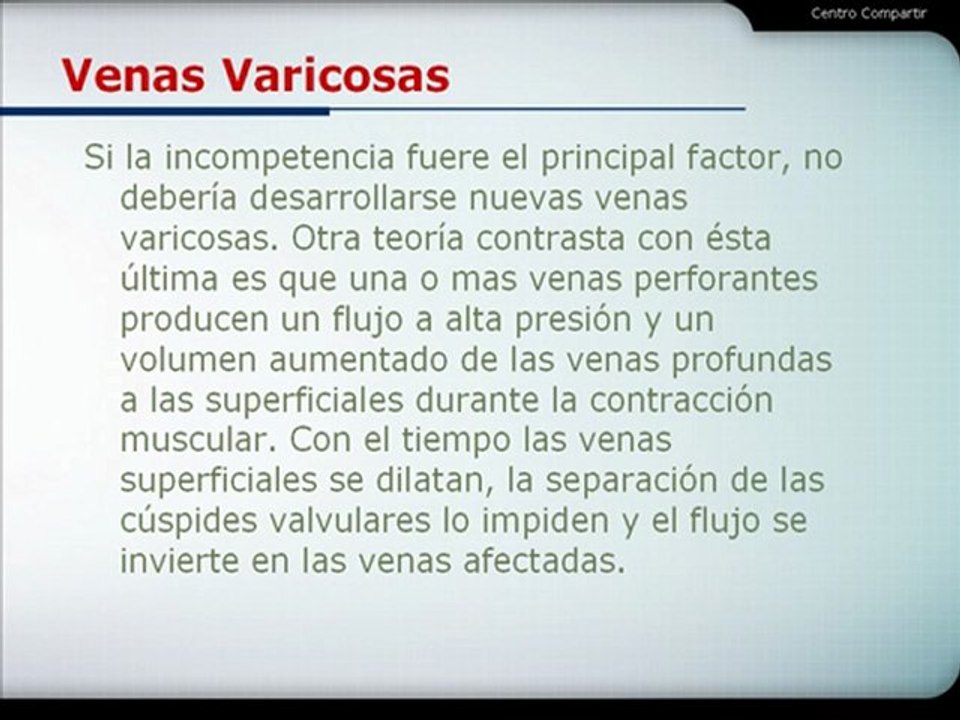 Venas Varicosas