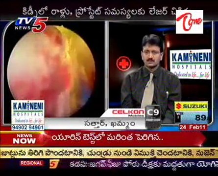 Health File - Kidney Stones - Prostate Problems & Treatments - 02