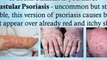 treatments for psoriasis - psoriasis in children - psoriasis genital