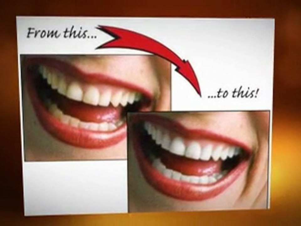 Broomall Cosmetic Dentist- The Secret to a Life-Changing Smile