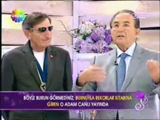 Deniz Akkaya'nın Burnuna Sahip Olmak İstemez misiniz?