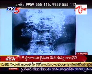 Sparsha,The Touch - Sex Problems,Treatment Advises by Dr.Kammala Sridhar - 02