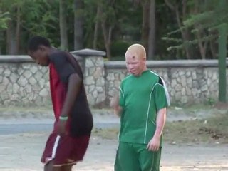 albinos targeted by ignorant people