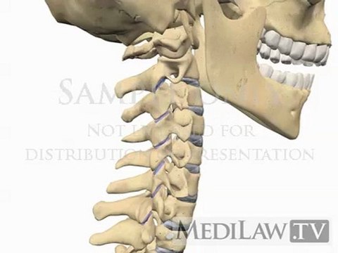 Cervical Spine Anatomy Vertebra Facet Joint Inter-vertebral Disc physiotherapy medical presentations