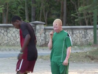 Des albinos créent une équipe de football en Tanzanie