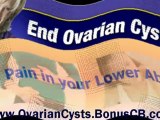 Ovarian Cyst Miracle - Ovarian Polycystic Syndrome - Ovarian