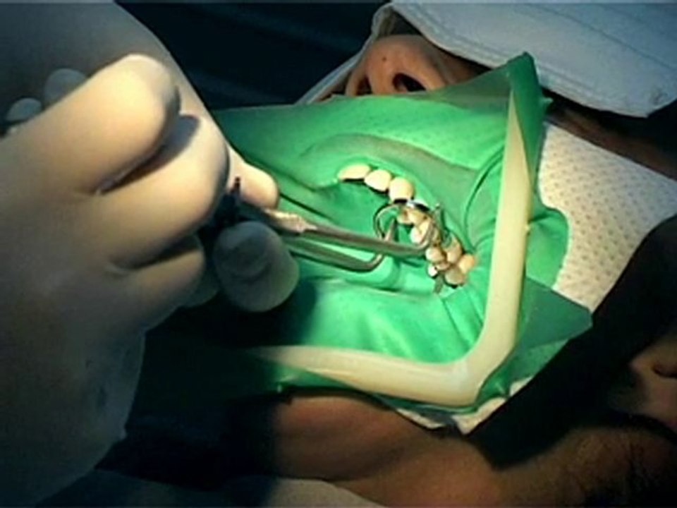 Démonstration X.flow de Dentsply