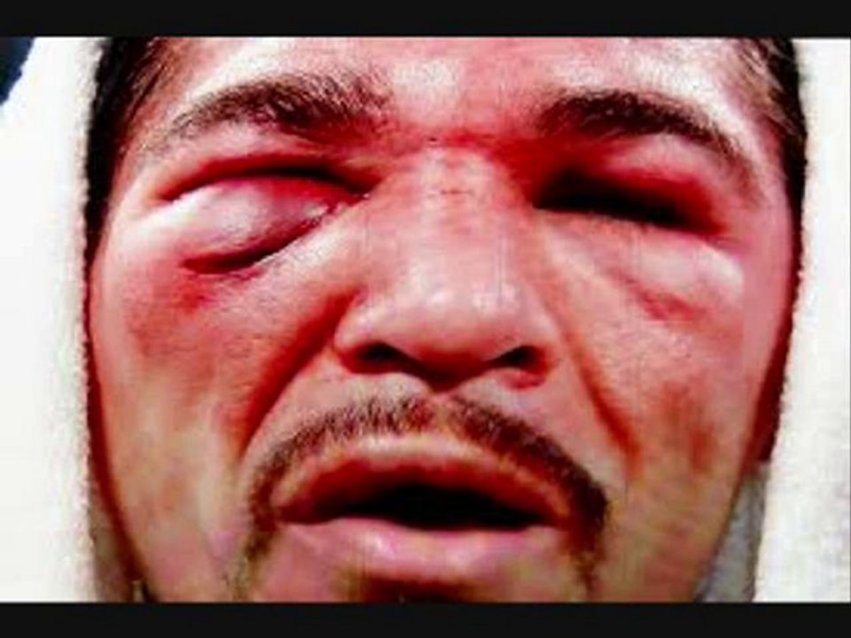 Watch Manny Pacquiao vs. Antonio Margarito (FIGHT VIDEO)